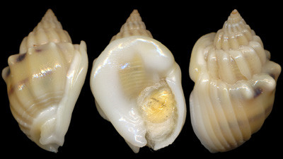 arcul varicoza