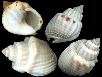 arcul varicoza